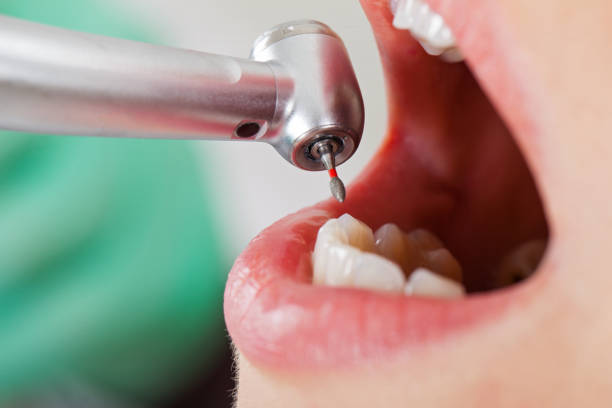 Best Walk-In Emergency Dental Services in Baldwin, LA